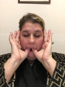Carey Benenson Taussig Osteo
