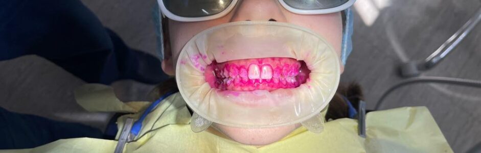 A Dentist’s Confession and the WOW factor of AIRPOLISHING